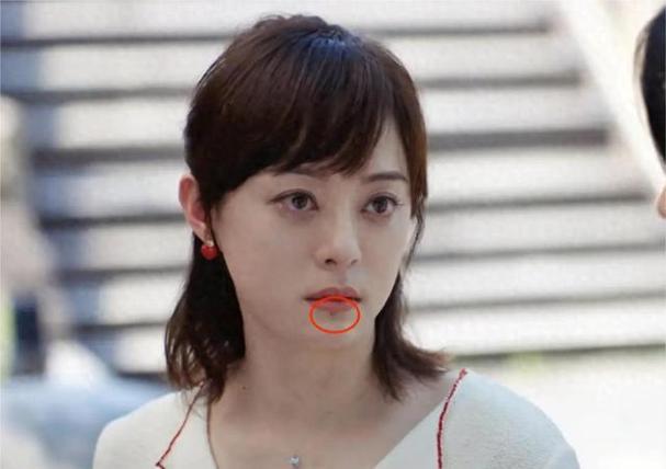 2025新奥资料正版大全和孙俪唇下痣没了与孙俪嘴唇的痣